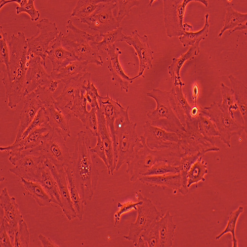 A875人黑色素瘤细胞（STR鉴定正确）