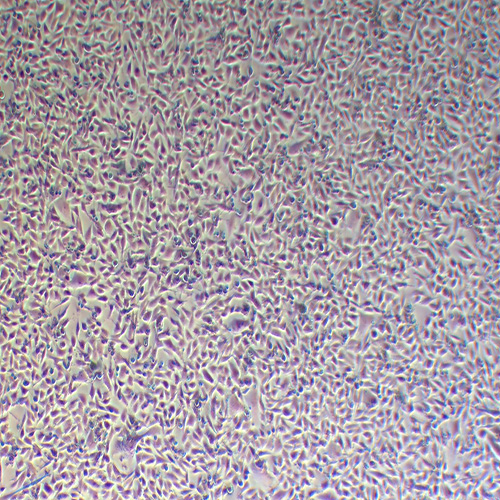 A2058人皮肤癌细胞（STR鉴定正确）