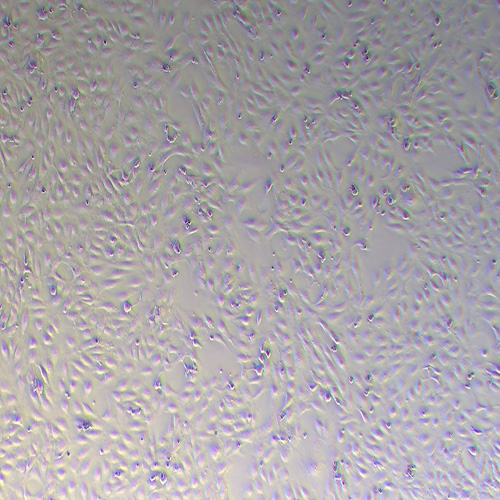 BEAS-2B人支气管上皮样细胞（STR鉴定正确）