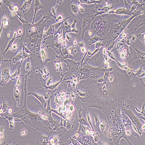 BT-549人乳腺管癌细胞（STR鉴定正确）