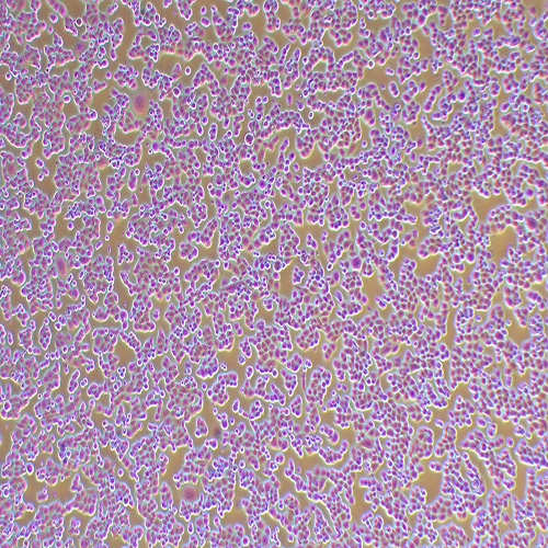 C33A人子宫颈癌细胞（STR鉴定正确）