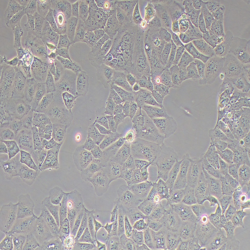 Caco-2人结直肠腺癌细胞（STR鉴定正确）