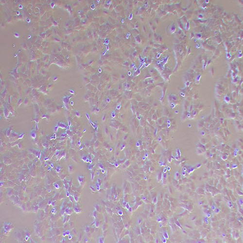 Caov-3人卵巢癌细胞（STR鉴定正确）
