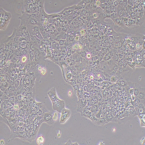 Capan-1人胰腺癌细胞（STR鉴定正确）