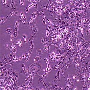 769-P人肾细胞腺癌细胞（STR鉴定）