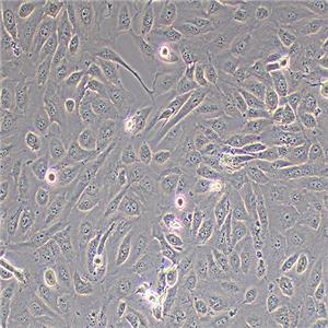 786-O人肾透明细胞腺癌细胞（STR鉴定正确）