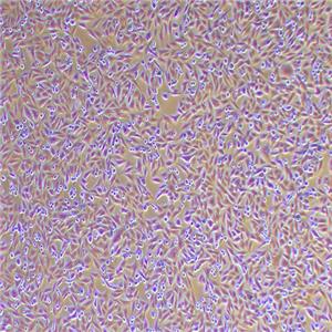 A375人恶性黑色素瘤细胞（STR鉴定正确）