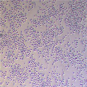 A549人非小细胞肺癌细胞（STR鉴定正确）