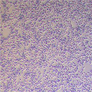 ACHN人肾细胞腺癌细胞（STR鉴定正确）