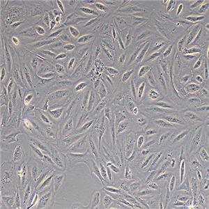 ARPE-19人视网膜色素上皮细胞（STR鉴定正确）