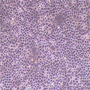 BGC-823人胃腺癌细胞(低分化)