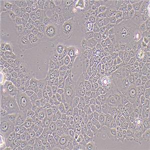 BxPC-3人原位胰腺腺癌细胞（STR鉴定正确）