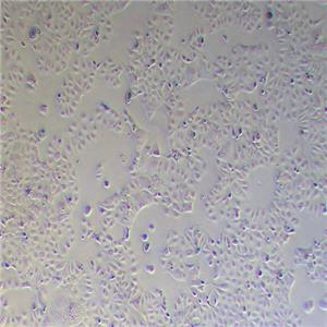 Caco-2人结直肠腺癌细胞（STR鉴定正确）