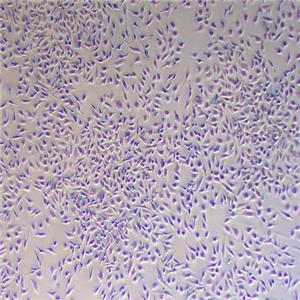 Caki-1人肾透明细胞癌皮肤转移细胞（STR鉴定正确）