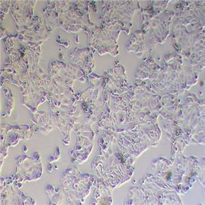 Calu-3人肺癌细胞（STR鉴定正确）