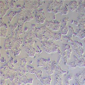 Capan-1人胰腺癌细胞（STR鉴定正确）