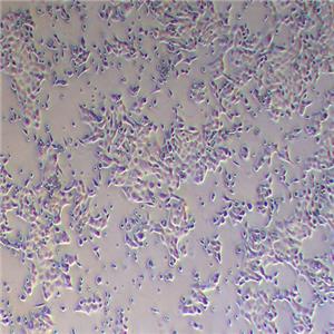 CFPAC-1人胰腺癌细胞
