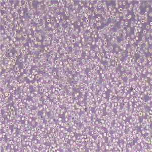 CoC1人卵巢癌细胞（STR鉴定正确）