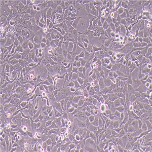 ECC-1人子宫内膜癌细胞（STR鉴定正