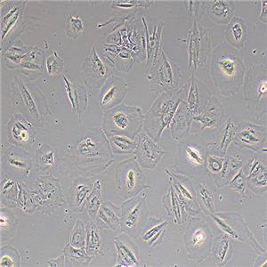 FHC人正常结肠上皮细胞（STR鉴定正确）