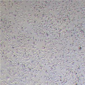 GBC-SD人胆囊癌细胞（STR鉴定正确）