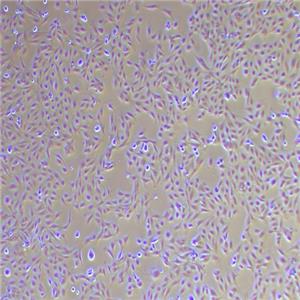 GES-1人胃黏膜上皮细胞（STR鉴定正确）