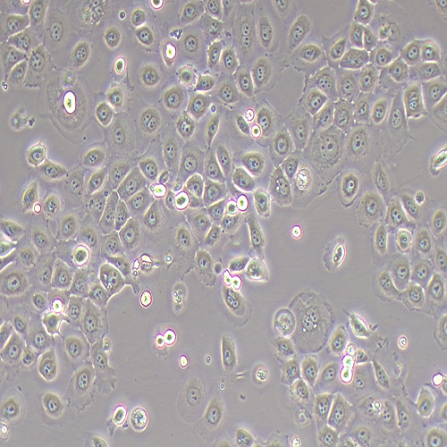 HCC 94人子宫鳞癌细胞（STR鉴定正确）