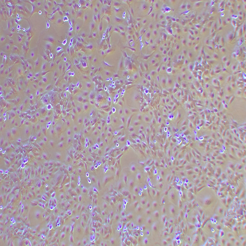HCCC-9810人胆管细胞型肝癌细胞（STR鉴定正确）