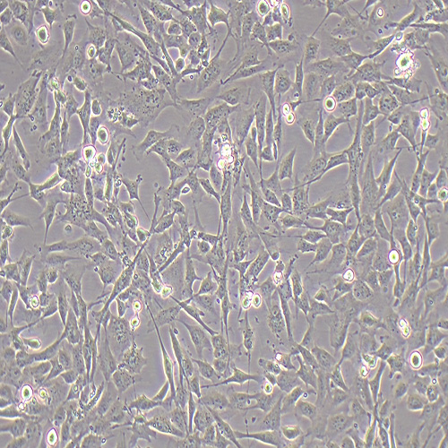 HCMEC/D3人脑微血管内皮细胞（永生化）（STR鉴定正确）
