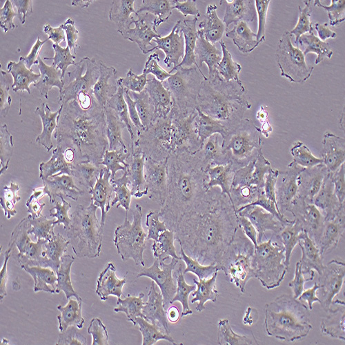 HS578T人乳腺癌細胞