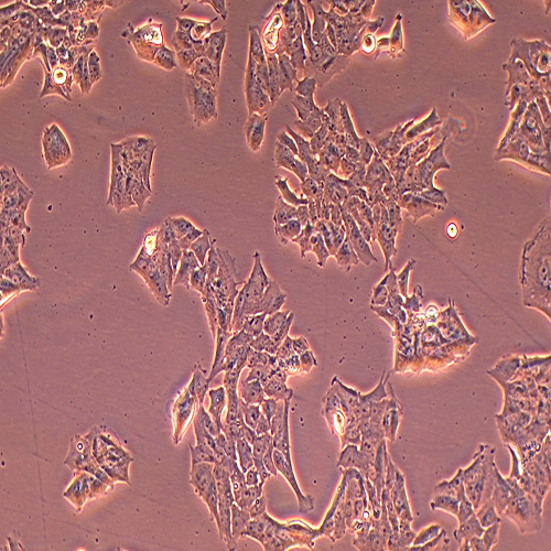 MDA-MB-361人乳腺癌细胞（STR鉴定正确）