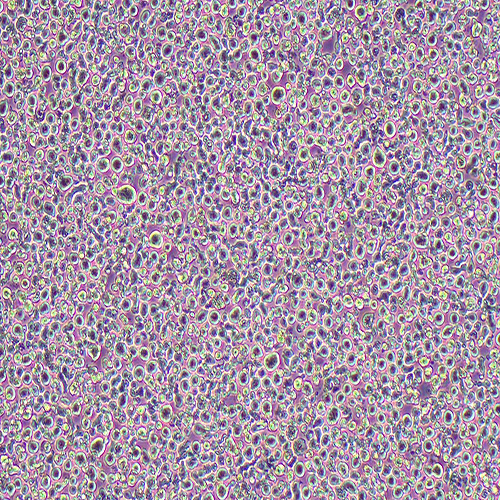 MM.1S人IgA-骨髓瘤细胞（STR鉴定正确）