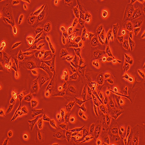 NCI-H157人非小细胞肺腺癌细胞（STR鉴定正确）