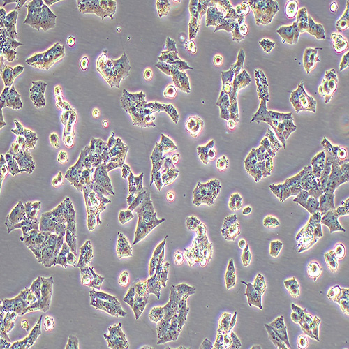 NCI-H295R人腎上腺皮質(zhì)腺癌細胞