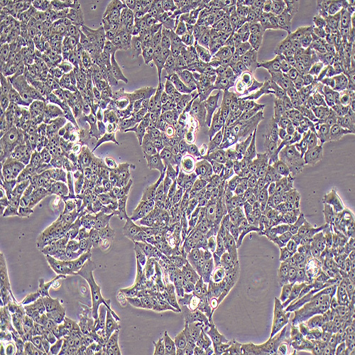 NCI-H358人非小细胞肺癌细胞（STR鉴定正确）