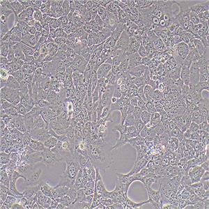 HCC827人非小细胞肺癌细胞（STR鉴定正确）