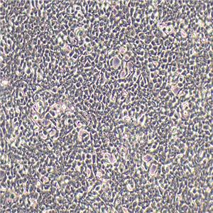 HEK-293A人胚肾细胞（STR鉴定正确）