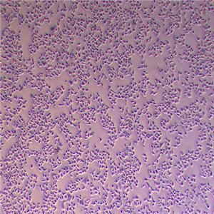 HELA人宫颈癌细胞（STR鉴定正确）