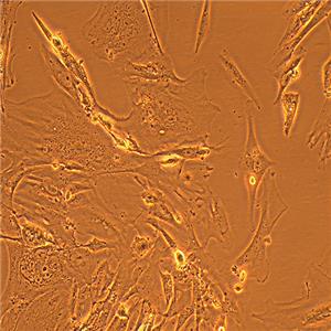 hEM15A人永生化子宫内膜异位症患者在位内膜间质细胞（STR鉴定正确）