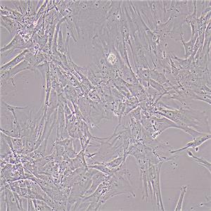 HFL-1人胚肺成纤维细胞（STR鉴定正