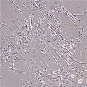 HFL-1人胚肺成纤维细胞（STR鉴定正