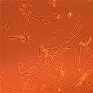HFLS-RA类风湿关节炎成纤维样滑膜细胞