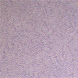 HL-7702人肝细胞（Hela污染细胞系）