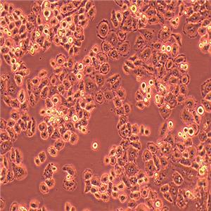 HO-8910PM人高转移卵巢癌细胞（STR鉴定正确）
