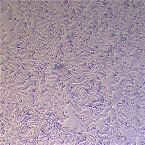 HOS人骨肉瘤细胞（STR鉴定正确）