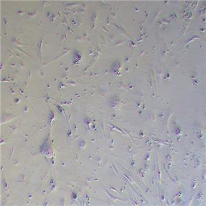 HRCEC人视网膜微血管内皮细胞