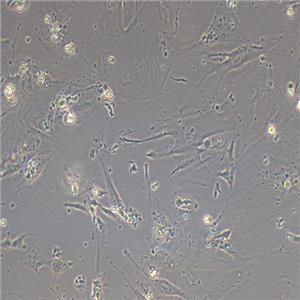 HRCEC人视网膜微血管内皮细胞
