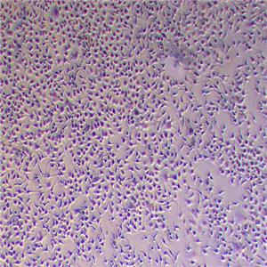 HuH-7人肝癌细胞（STR鉴定正确）