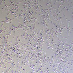 iehESCs人子宫内膜间质细胞(永生化)