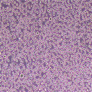 K562人慢性骨髓性白血病细胞系（STR鉴定正确）